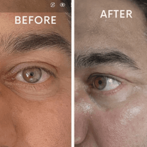 Anti-Ageing
